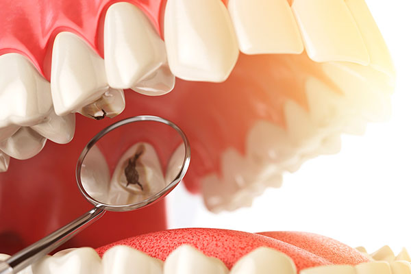 ODONTOLOGIA CONSERVADORA