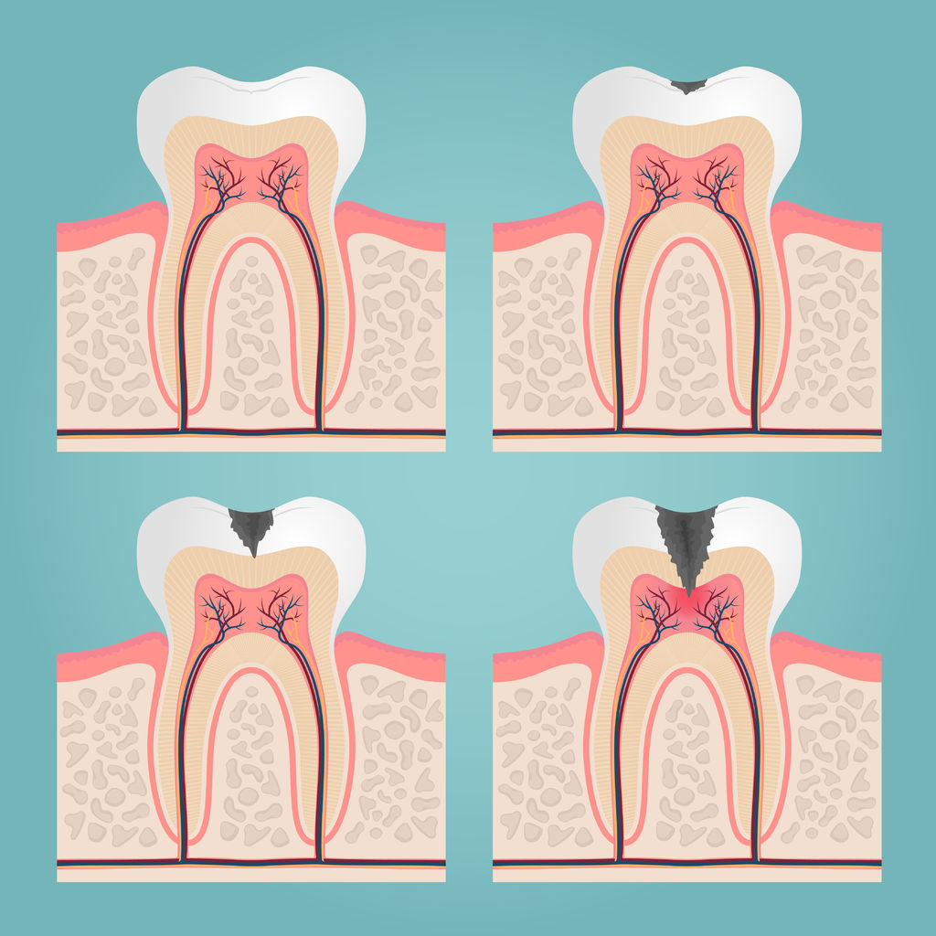Empaste dental
